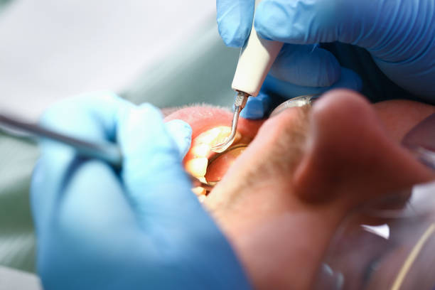 Best Emergency Dentist for Knocked-Out Tooth in Birdsboro, PA