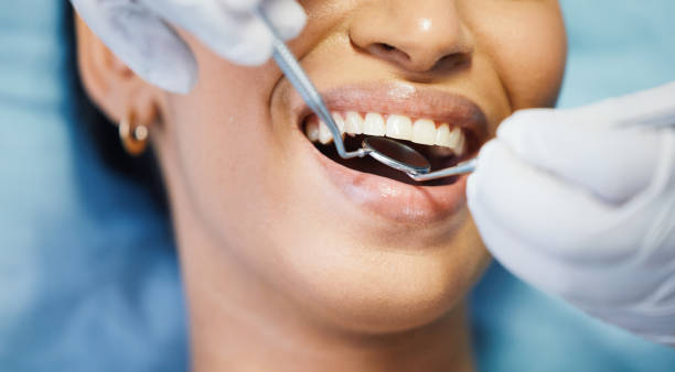 Best Broken or Cracked Tooth Emergency Dentist in Birdsboro, PA